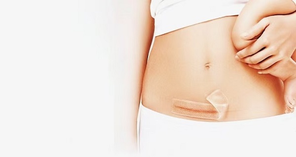 Чому товсті силіконові гелеві листи від рубців такі популярні?