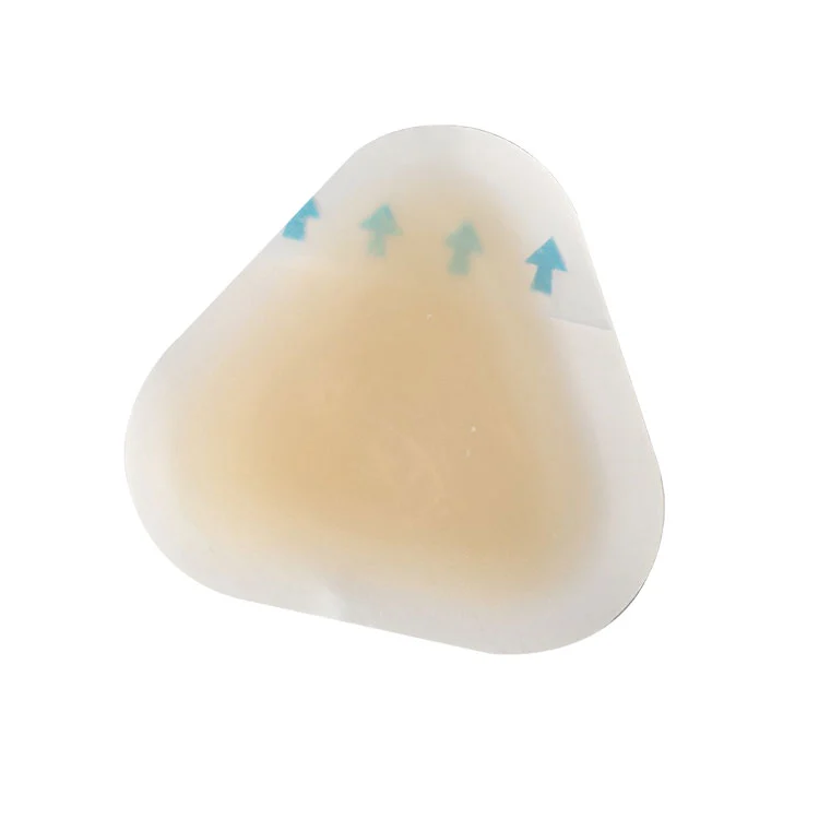 Стерильна профілактика пухирів на п'ятах